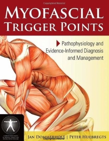 Myofascial Trigger Points : Pathophysiology and Evidence Informed Diagnosis and Management